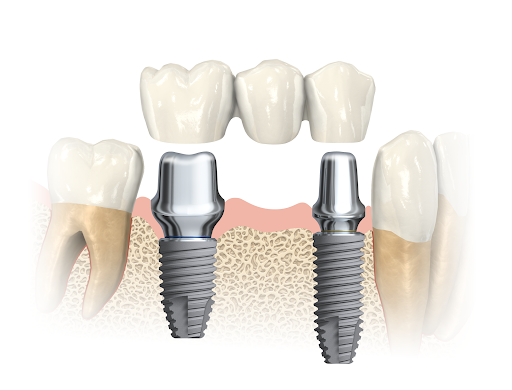 AGUILARS Clínica Odontológica